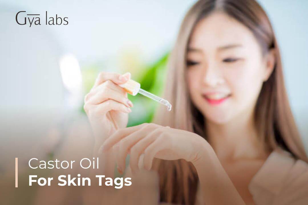 Benefits Of Castor Oil For Skin Tags | Get Rid Of Skin Tags With Castor Oil | GyaLabs