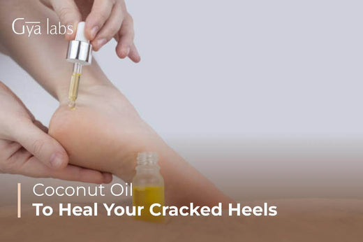 Coconut Oil for Heels