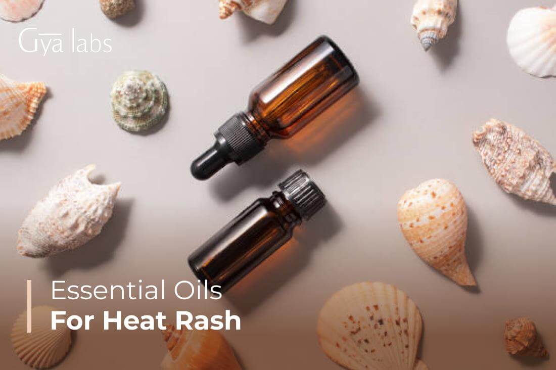 Best Essential Oils For Heat Rash | Prickly Heat Oils For Soothing Skin