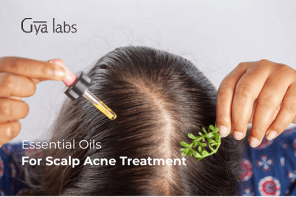 Essential Oils for Scalp Acne Treatment - Natural Remedies to Reduce Breakouts | GyaLabs