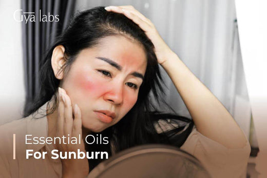 Essential Oils for Sunburn