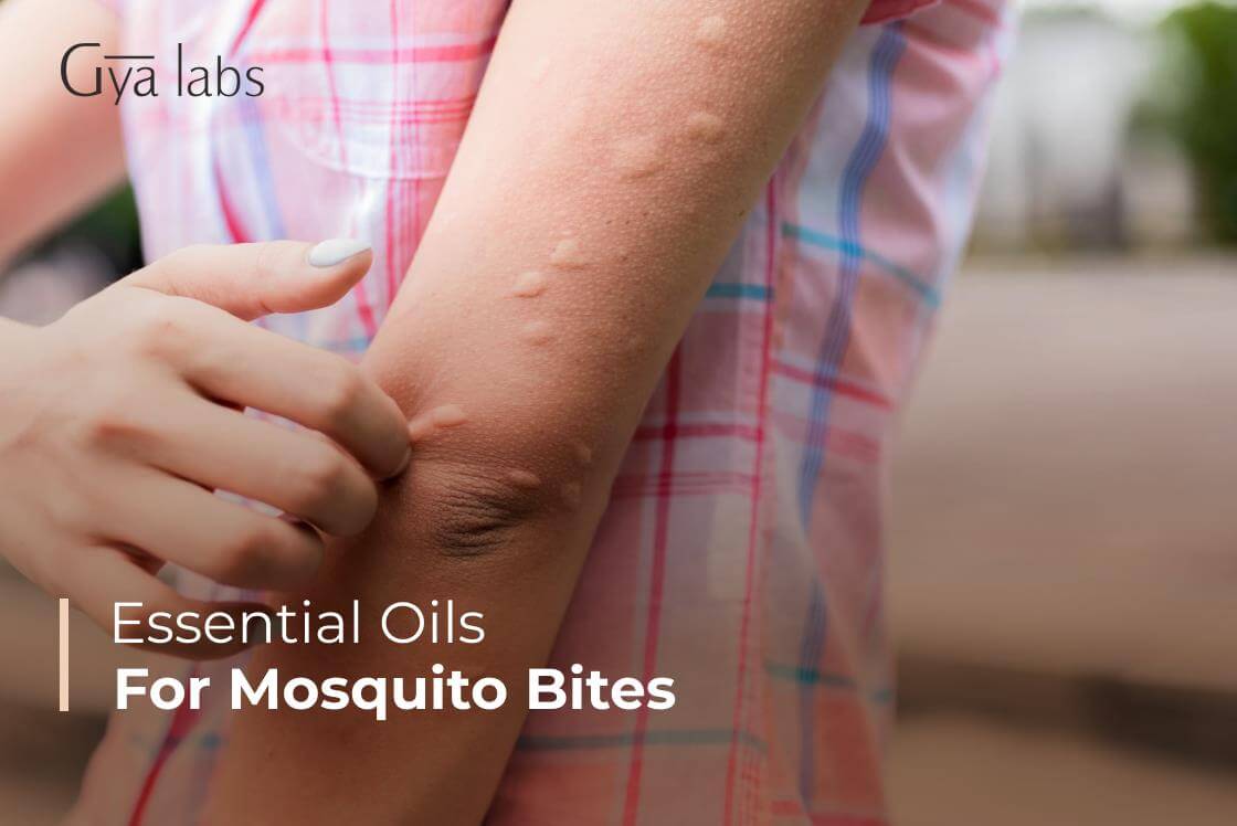 18+ Best Essential Oils For Mosquito Bites | Essential Oils To Prevent Mosquito Bites | GyaLabs