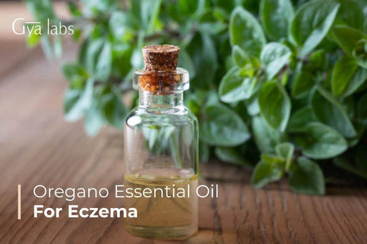 Oregano Oil for Eczema