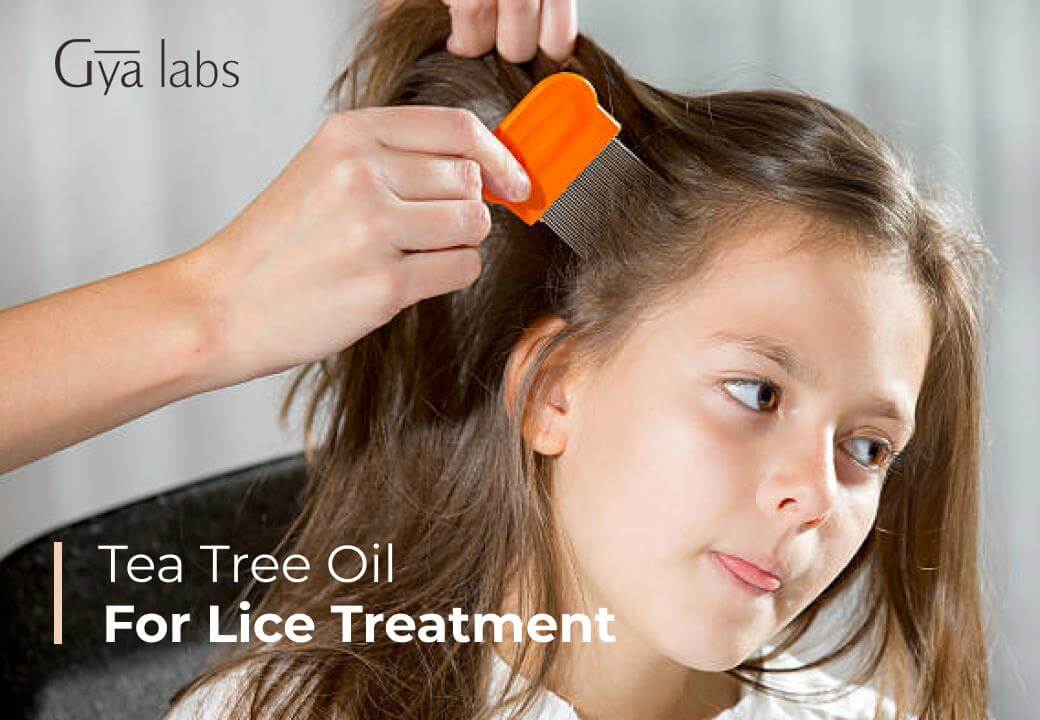 Using Tea Tree Oil For Lice Treatment (With Witch Hazel Recipe)