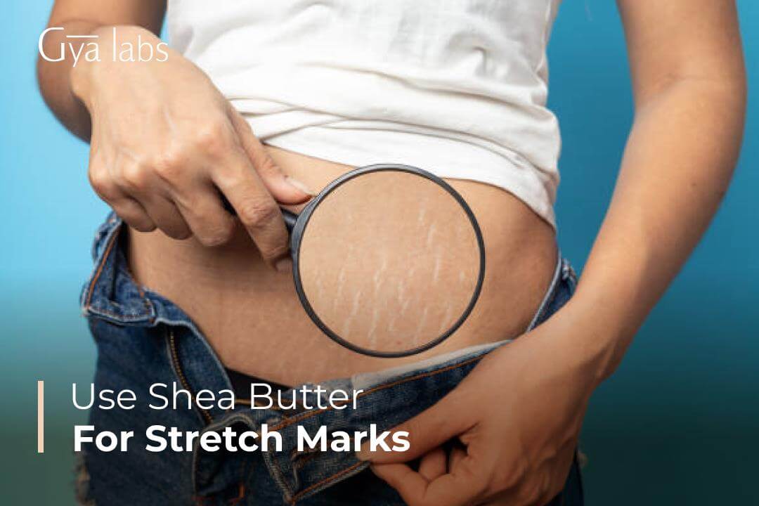 Use Shea Butter For Stretch Marks: The Perfect Remedy