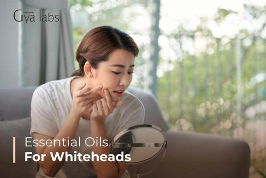 Essential Oils for Whiteheads